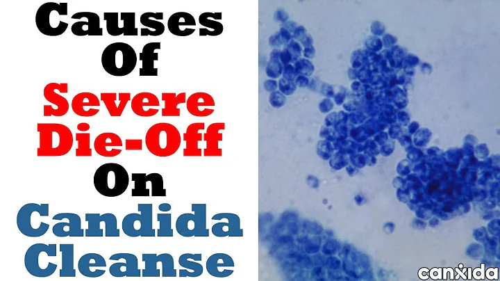 Candida Infante Photo 5