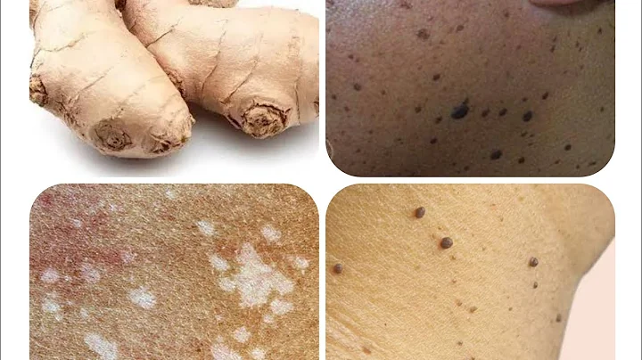 Ginger White Photo 39