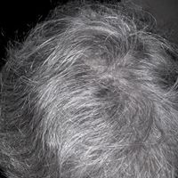 Gilbert Dupuis Photo 1