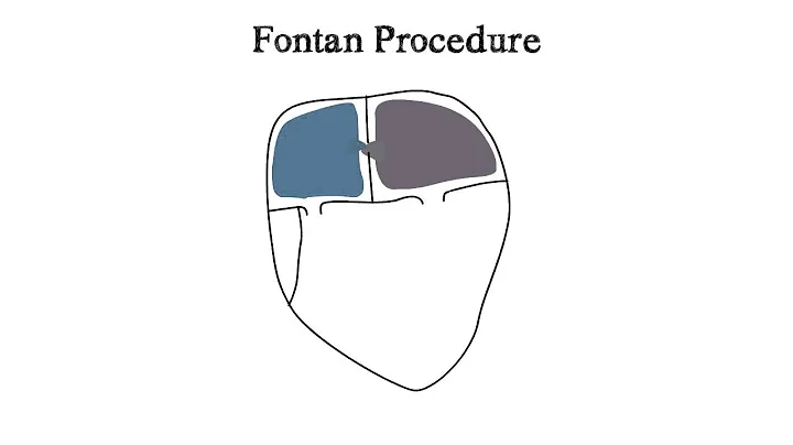 John Fontan Photo 13