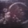 Brandy Queen Photo 14