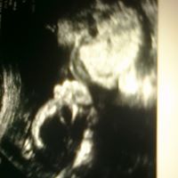 Elizabeth Peraza Photo 4