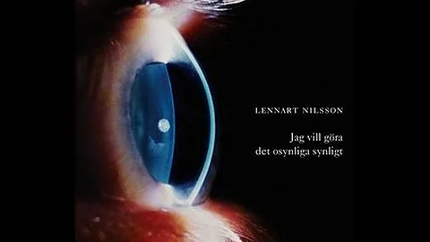 Lennart Nilsson Photo 14