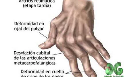 Ana Quinteros Photo 20