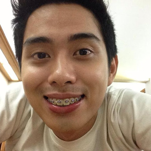 Johnny Lim Photo 10