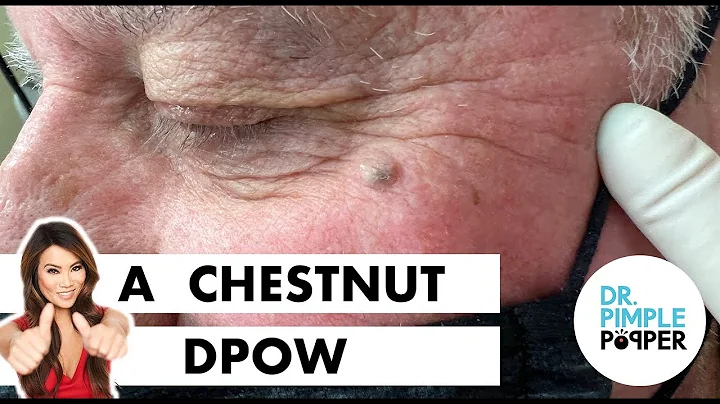 Lee Chestnut Photo 11
