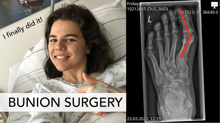 Lillie Bunion Photo 5