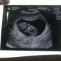 Emily Conley Photo 27
