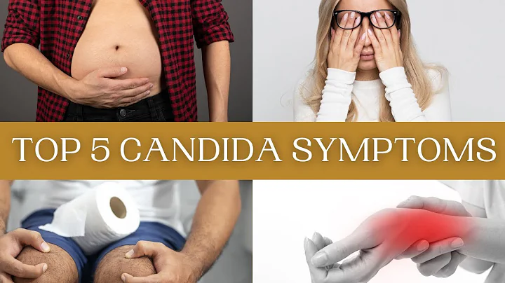 Candida Infante Photo 2