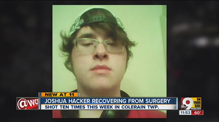 Joshua Hacker Photo 24