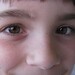 Deven Brown Photo 28