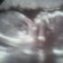 Teonna Harris Photo 9