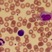 A Blood Photo 21